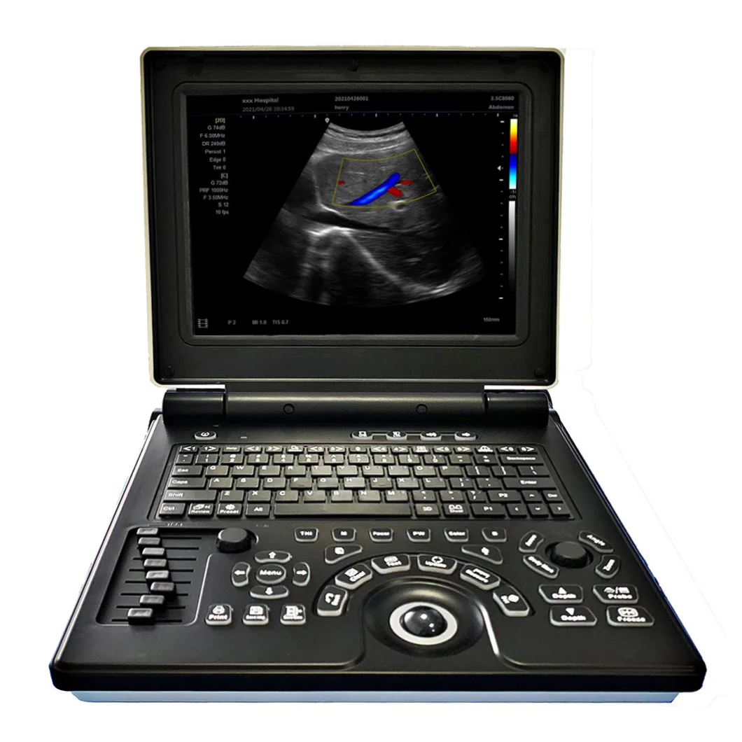 HUC-180 Full Digital 3d Laptop Color Doppler Ultrasound Diagnostic System Portable Ultrasonography Machine with Printer