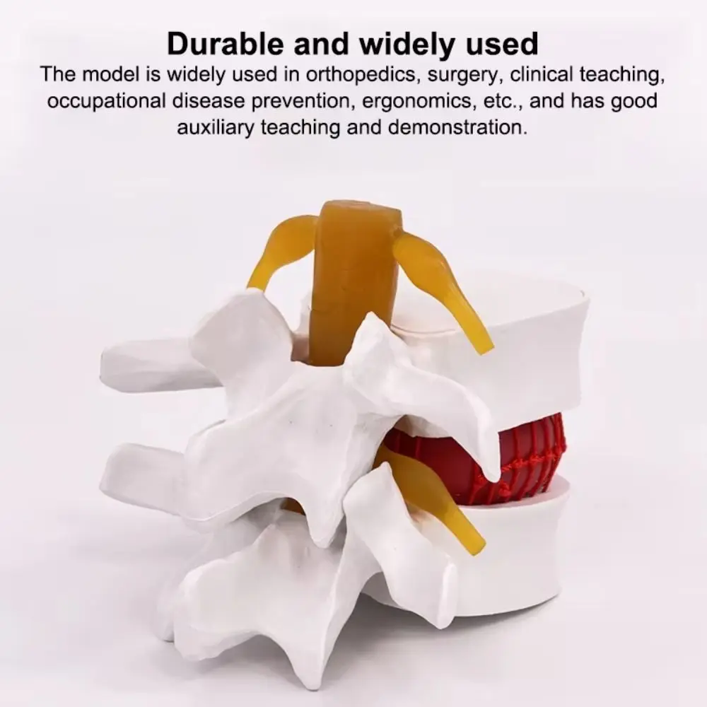 3D Model Lumbar Model 1.5X Enlarge Compression Demonstration Human Anatomy Skeleton Model Simulation Spinal Pressure Lesions