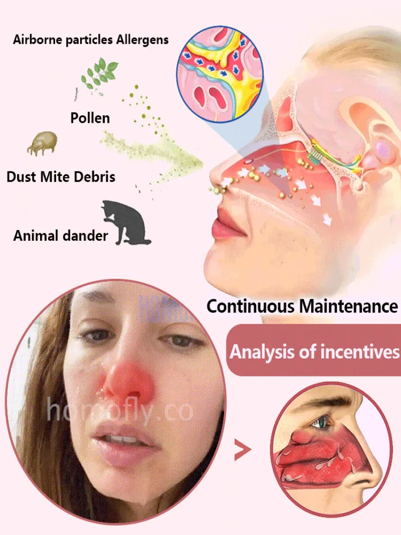 Odżywka do nosa czysty nos łagodzi przekrwienie błony śluzowej nosa suchy nos dyskomfort w oddychaniu dobrze odświeżający pielęgnacja twarzy stylizacji nosa