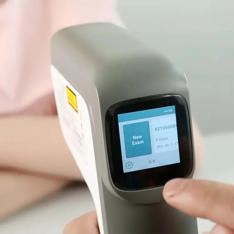 

【Factory】Aist Optical Instrument Digital Portable Autorefractometer Ophthalmology Auto Refractometer Factory Autorefractometro P