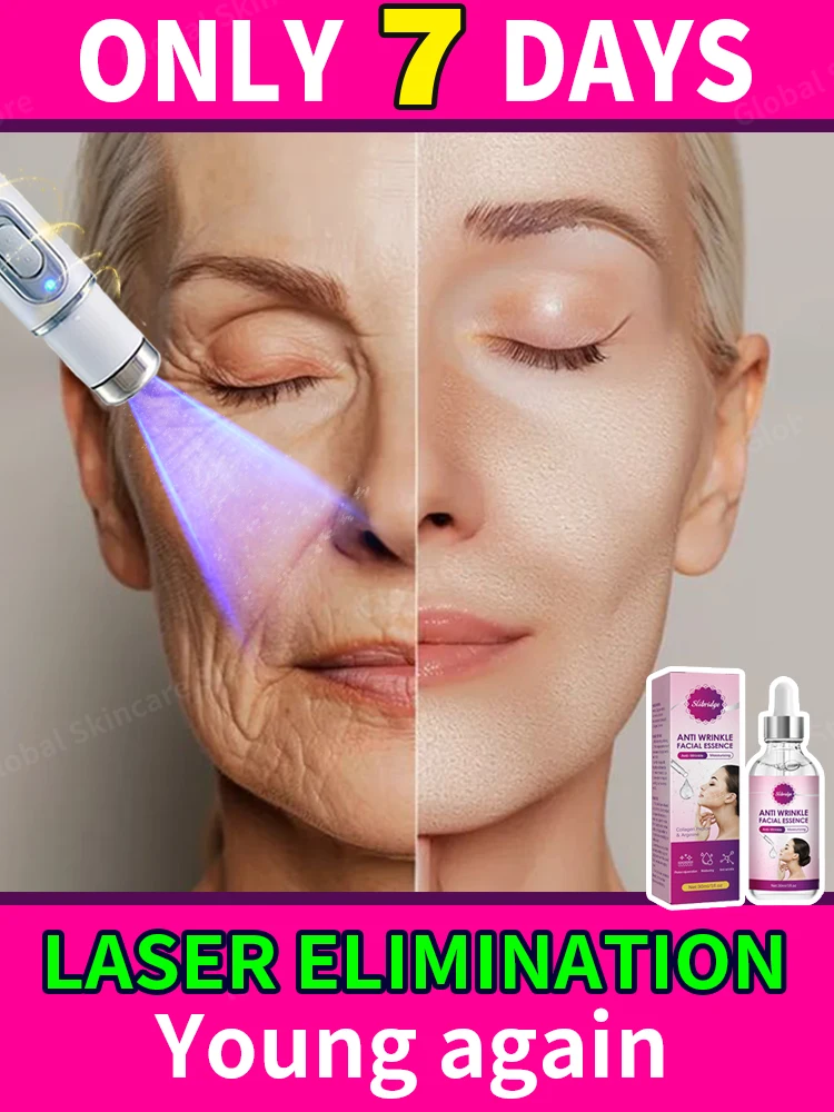 Laser Product For Solves wrinkle Problems