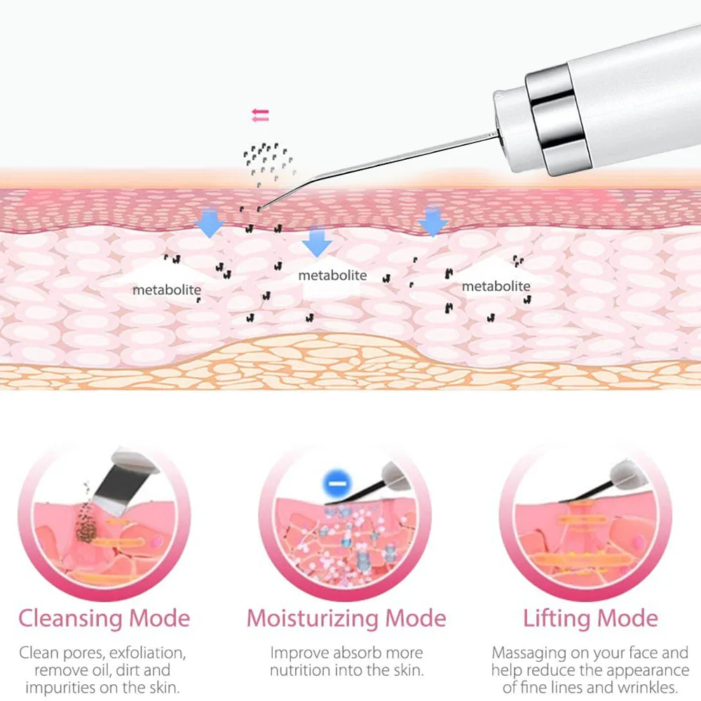 Elektrische Ultrasone Huid Scrubber Gezichtsreiniging Porie Diepe Reiniger Acne Comedondrukker Peeling Schop Apparaat Schoonheid Machine