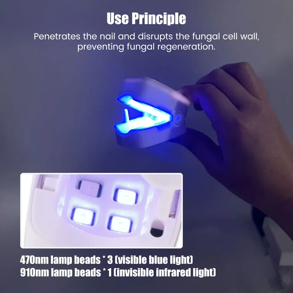 Nail Fungus Laser Treatment Device Professional Onychomycosis Therapy Cure Machine for Broken Cracked Split and Weak Nails