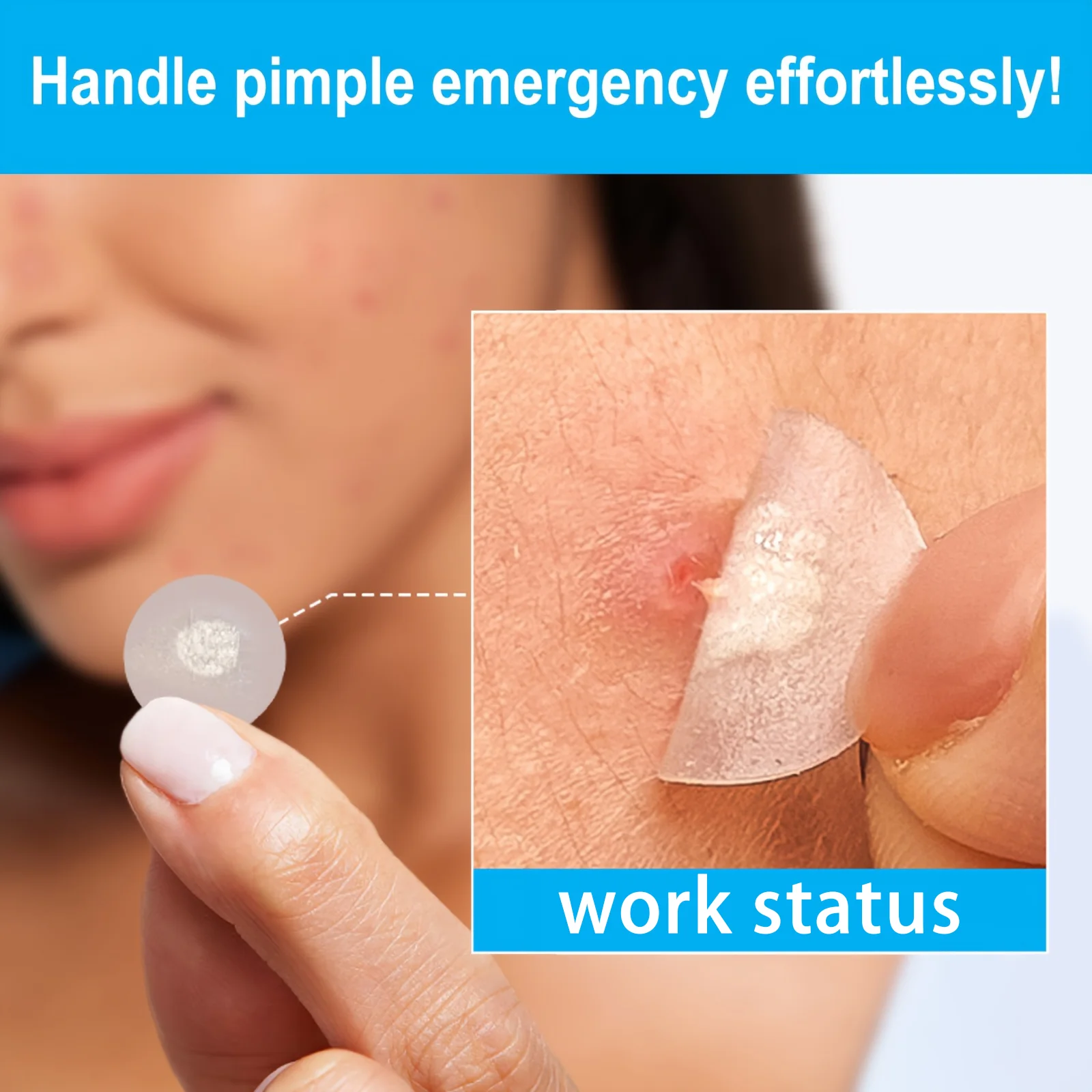 Patches Hidrocoloidais para Acne, Essência de Limpeza Facial, Acessório de Ferramenta, Invisível e à Prova d'Água, Adequado para Todos os Tipos de Pel