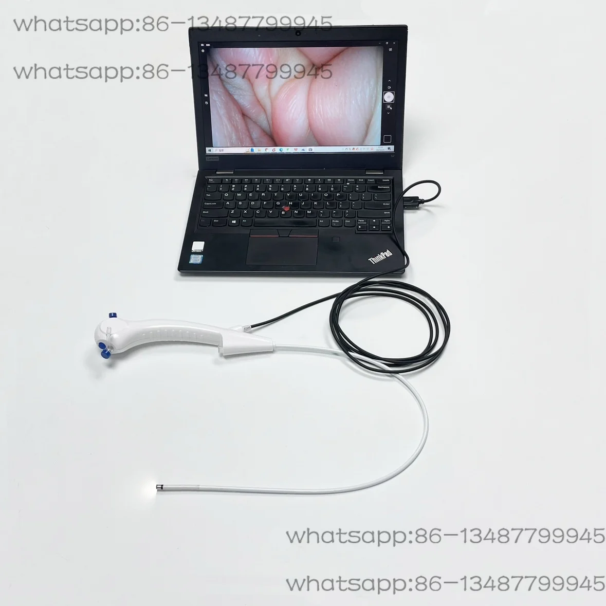 Pet animal endoscope, flexible bronchoscope, bronchoscope, electronic nasopharyngoscope for foreign body removal