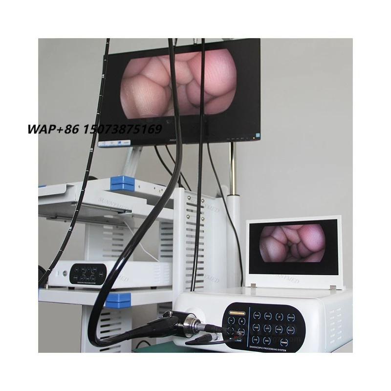 SY-P033 Portable 1080P ull high definition Veterinary Rigid Endoscopy System for Animal Examination and Surgery