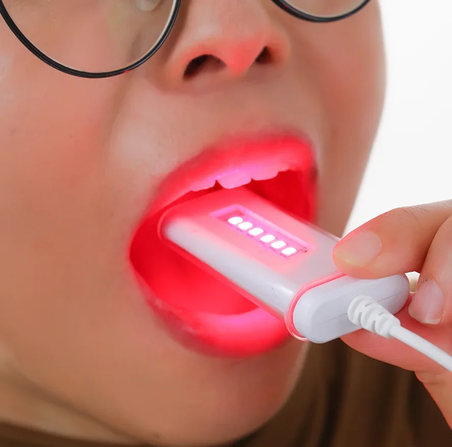 New Upgraded 650nm Laser Therapy Dental Oral Ulcer Instrument Teeth Pain Relief Lip Sore Canker Homeuse Oral Physiotherapy