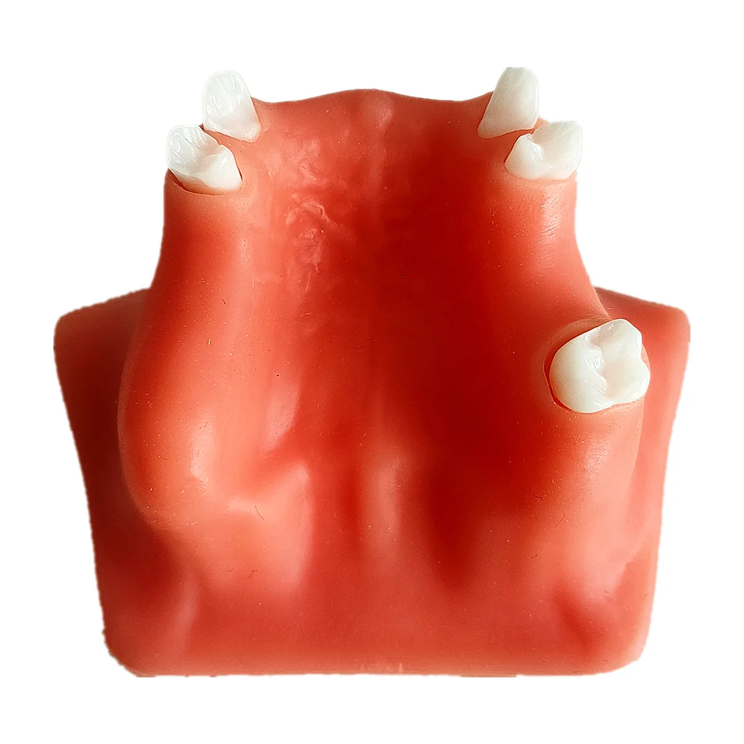 

1PCS Dental Practice Model Maxillary Lift Model Upper Sinus Lifting Implant Training