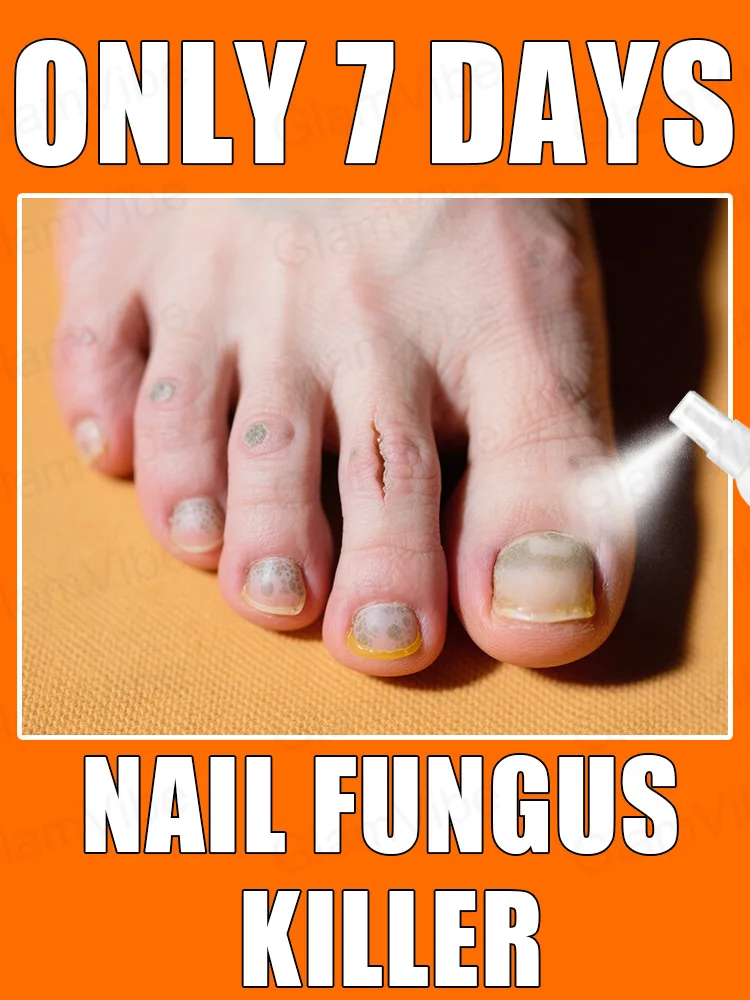 

2025 Toenail Fungus Patch Waterproof Nail Repair Patches Nail Ingrown Correction Sticker Discolored Damaged Nail Foot Care Tool