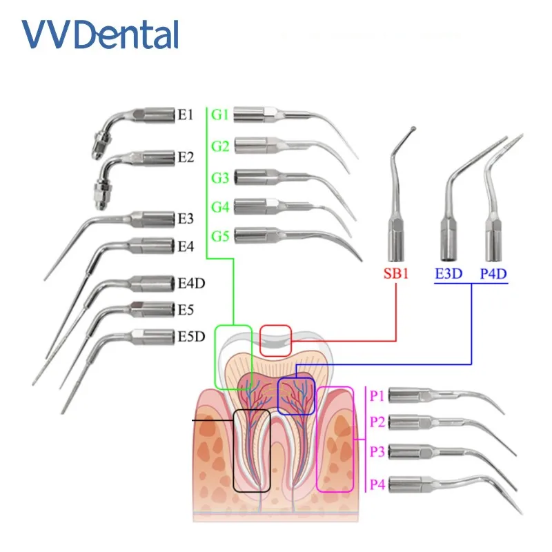 

VV Dental Ultrasonic Scaler Tip High Quality Stainless Steel G1 G2 G3 G4 G5 G6 P1 P3