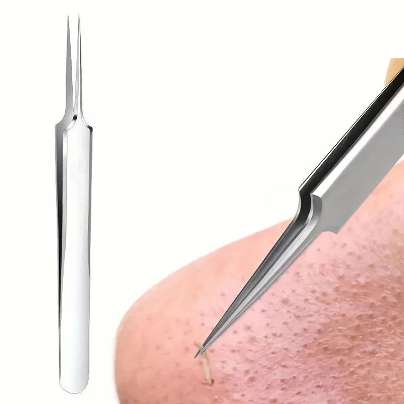 極細No.1パック 5 つの細胞ニキビにきびピンセット - 顔の美しさを除去するニキビ針ツール、スキンケア用