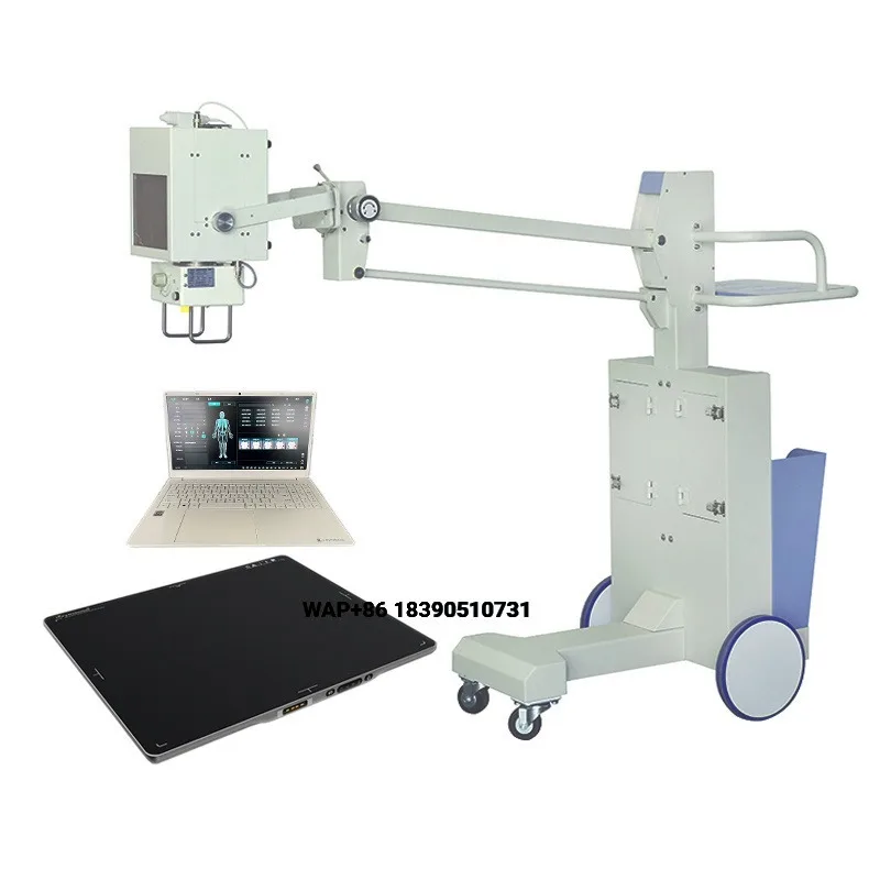 Mobile X-ray Machine 100mA High Frequency X-ray MachineOutpatient Whole Body Examination Mobile X-ray Machine