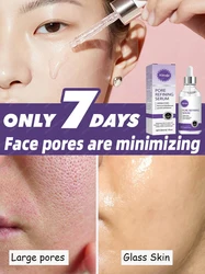 Pore Minimizer Serum For Face Pore Facial Pore Narrowing Serum Pore Contraction Tightens Essence Shrink Pores Serum