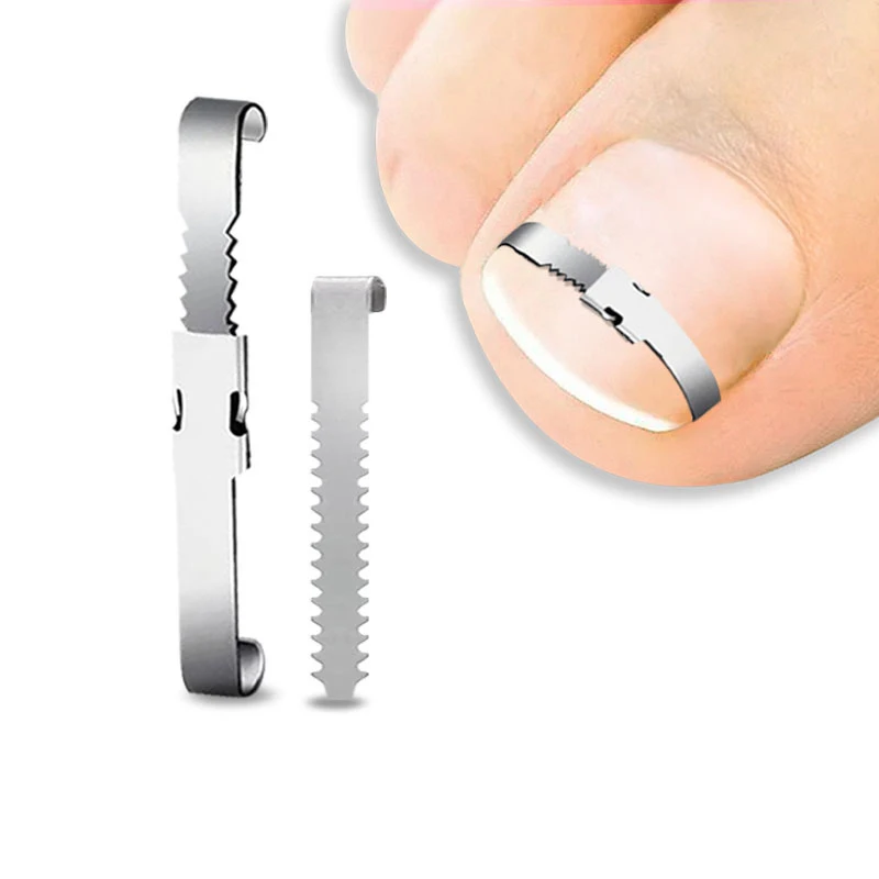 Outils de Correction des Ongles Incarnés, Traitement Professionnel pour la Pédicure et la Récupération des Ongles Incarnés, Outil de Soin des Pieds
