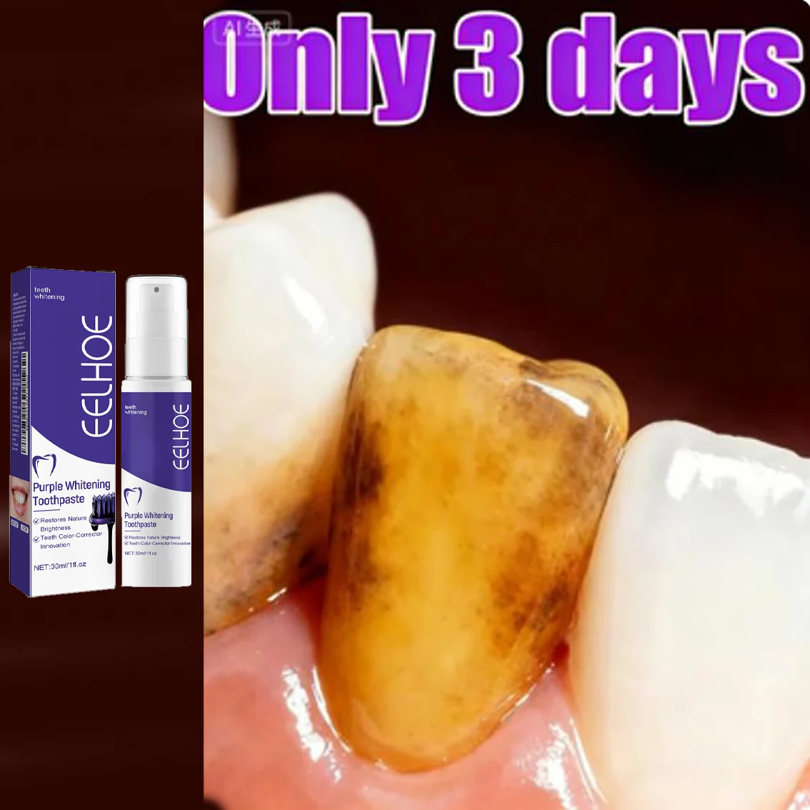 

best seller New upgraded tooth powderᴵᵗ ᵇʳⁱᵍʰᵗᵉⁿˢ ᵃⁿᵈ ᑫᵘⁱᶜᵏˡʸ ʳᵉᵐᵒᵛᵉˢ ᵒʳᵃˡ ᵇᵃᶜᵗᵉʳⁱᵃ Whitening and cleansing