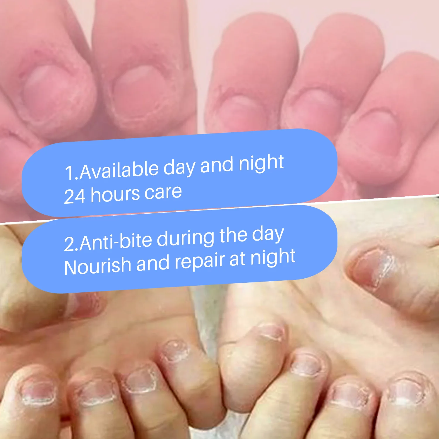 15ml เด็ก Anti-กัดเล็บ Bitter เล็บน้ําไม่มีกัดหนังกําพร้าไม่เล็บกัด Care ปลอดสารพิษหยุดกินเล็บ