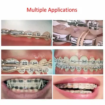 Zubní super elastické latexové rovnátka gumové pásky 5oz ortodontický ligační kroužek ortopedické léčebné materiály 10 nejlepší prodej ligové pavouky - №2