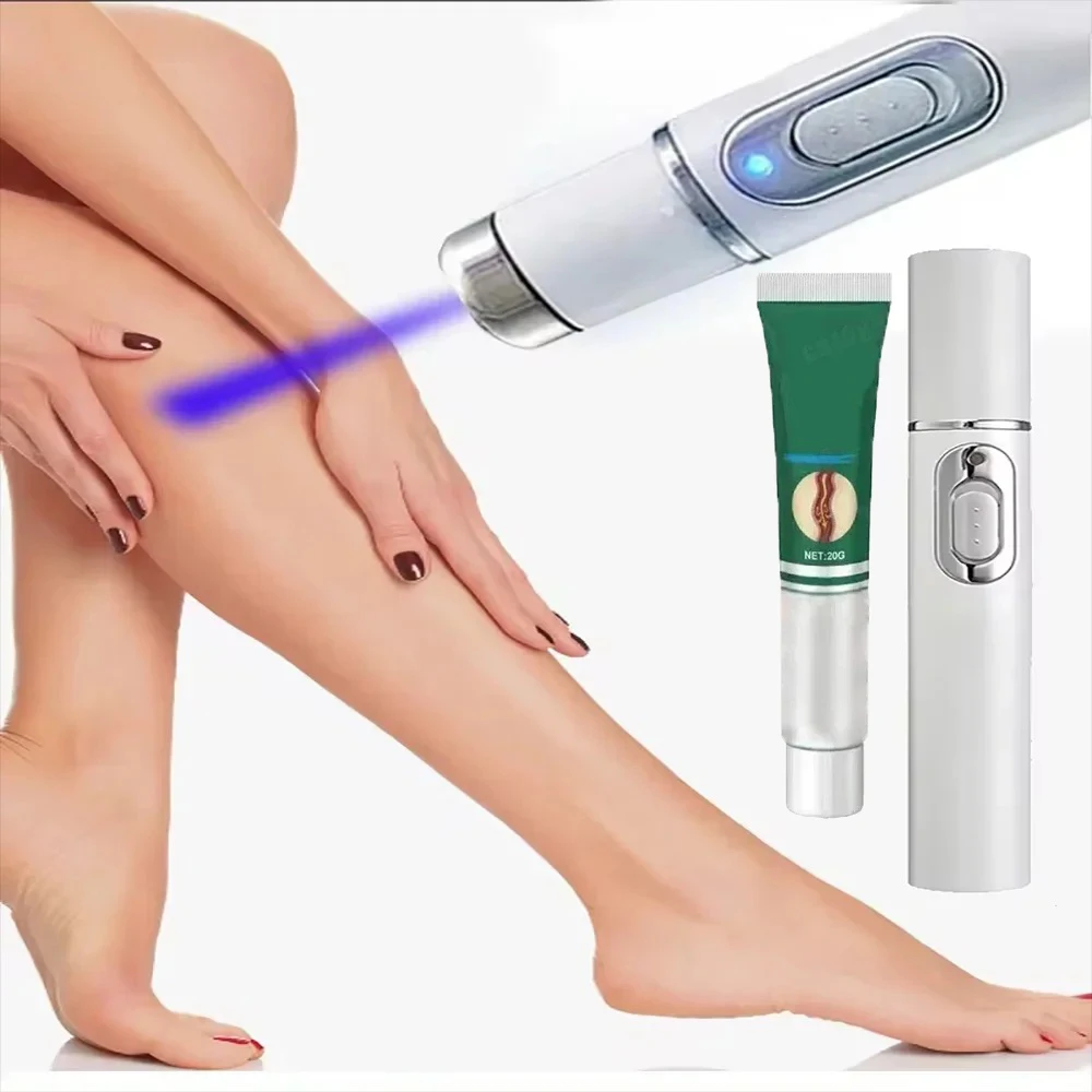 

Модернизированная лазерная ручка для варикозного расширения вен, медицинское устройство для инфракрасной терапии 980 нм, паукообразные вены и крови ног. Безболезненное лечение с помощью