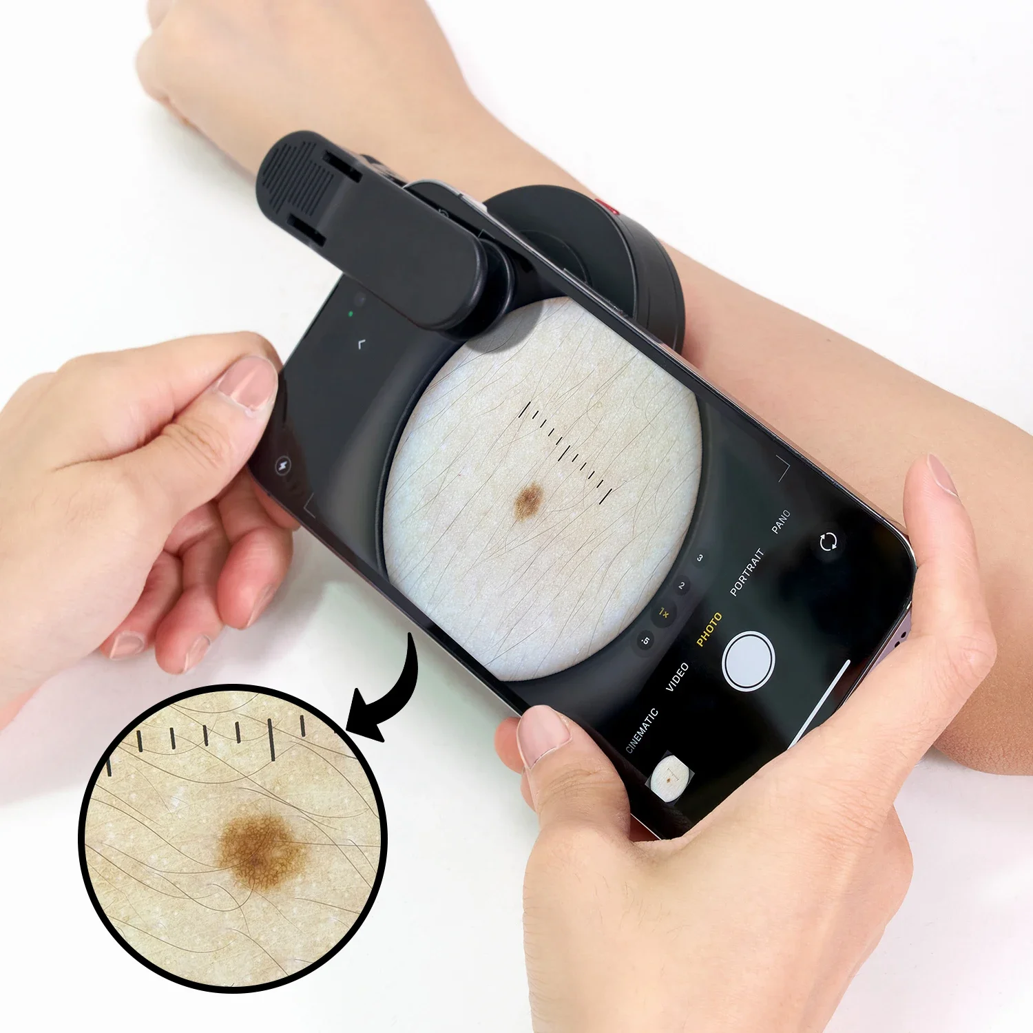 Contact Dermatoscop…