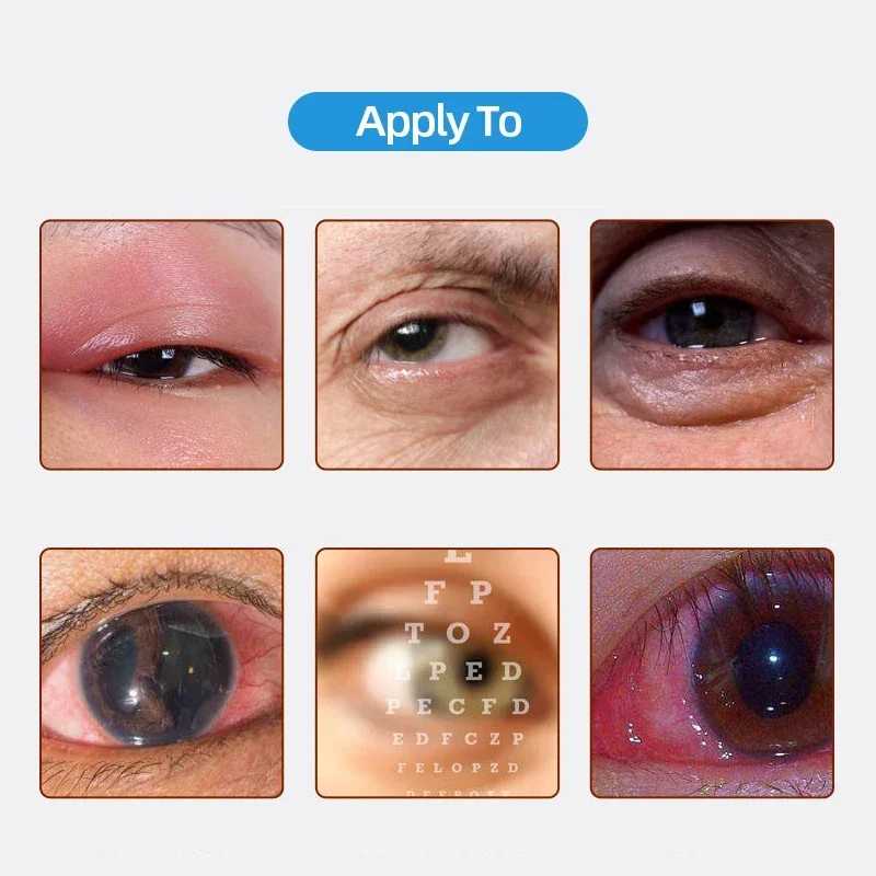 Gouttes oculaires médicales pour le traitement de la cataracte, appliquer à la vision floue, chevauchement de l'ombre noire, globe oculaire nuageux, approuvé par la Cfda, dieux vitaminés, E