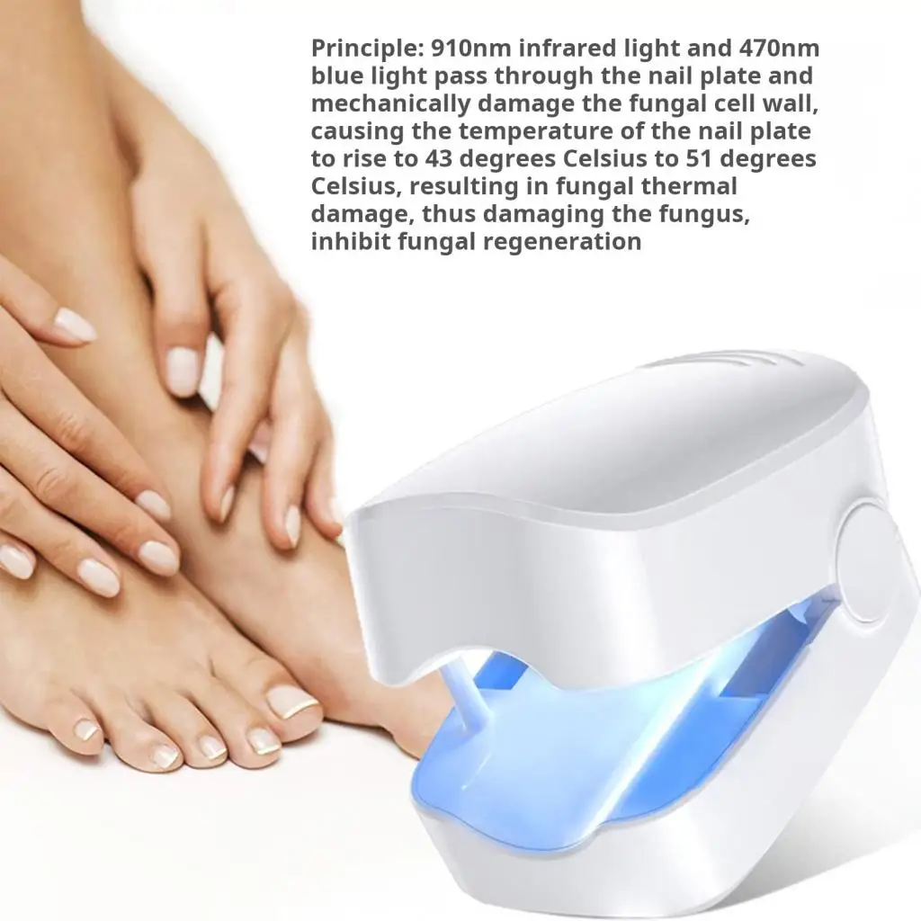 جهاز علاج منزلي لعلاج الأظافر، مصباح علاج فعال لفطريات الأظافر، لإزالة فطار الأظافر بالضوء الأزرق