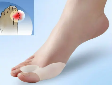 Toe Bunion Protector Roller Set