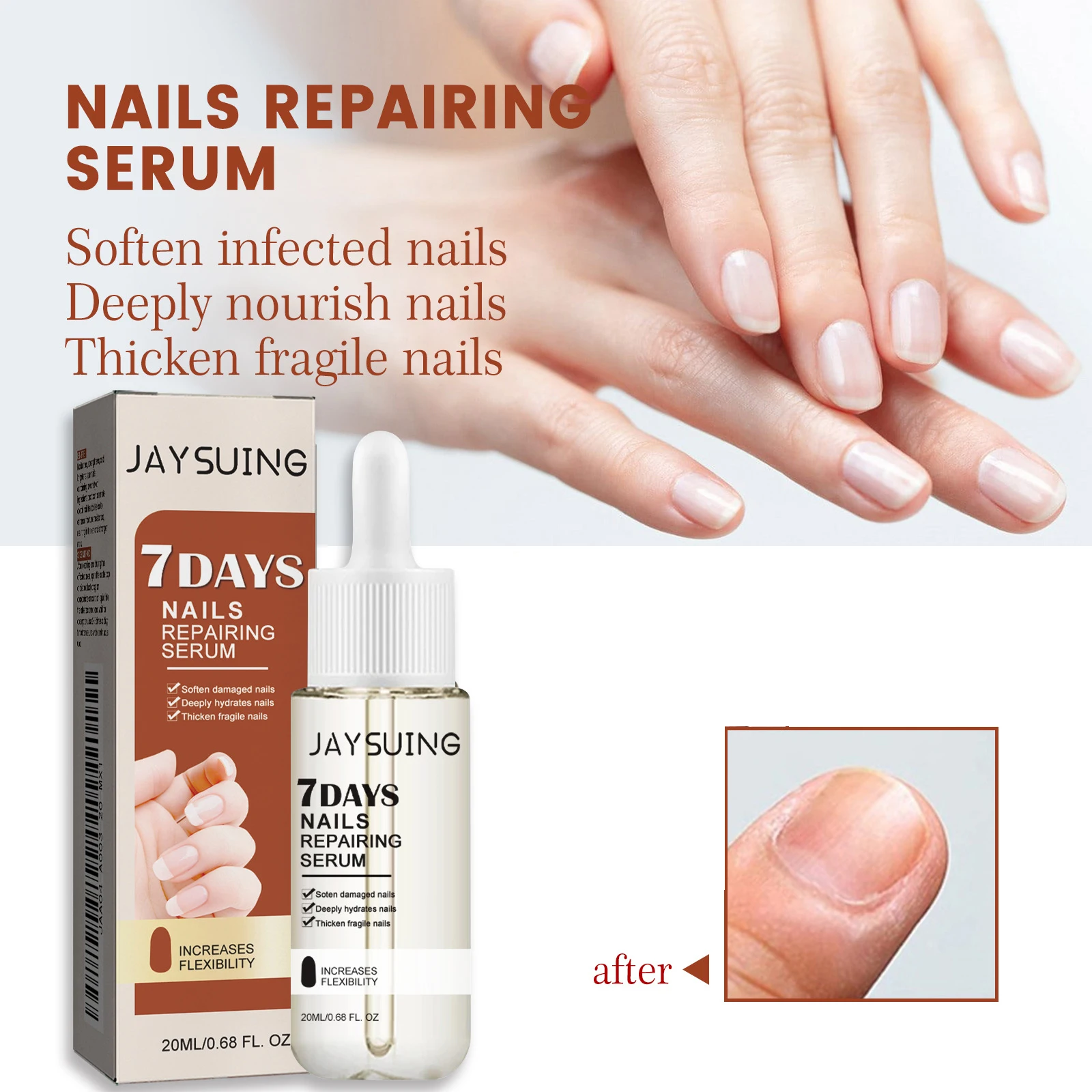 20ml Nail Repairing Serum 7 Days Nail Care Oil Repair Inlaid Armor Onychomycosis For Hands Feet