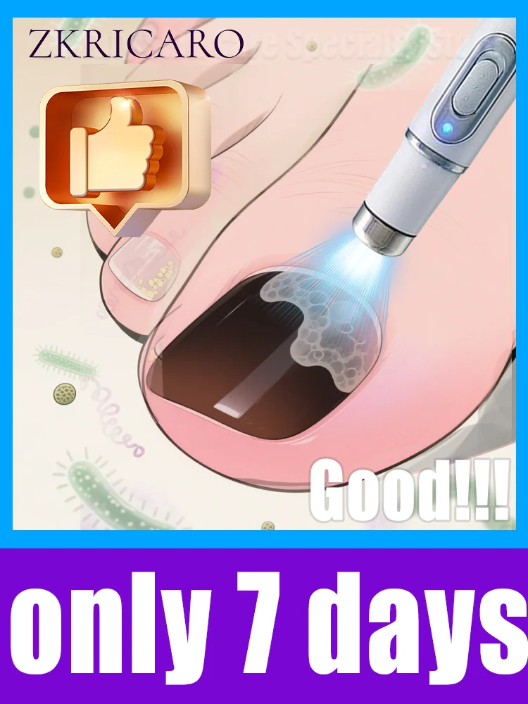 

Onychomycosis laser pointer third generation blue light new upgrade