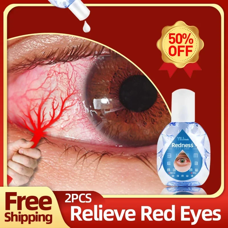 Red Eyes Treatment Products Apply To Relieves Eyes Infection Dry Itchy Redness Discomfort Health Care Red Eye Drops