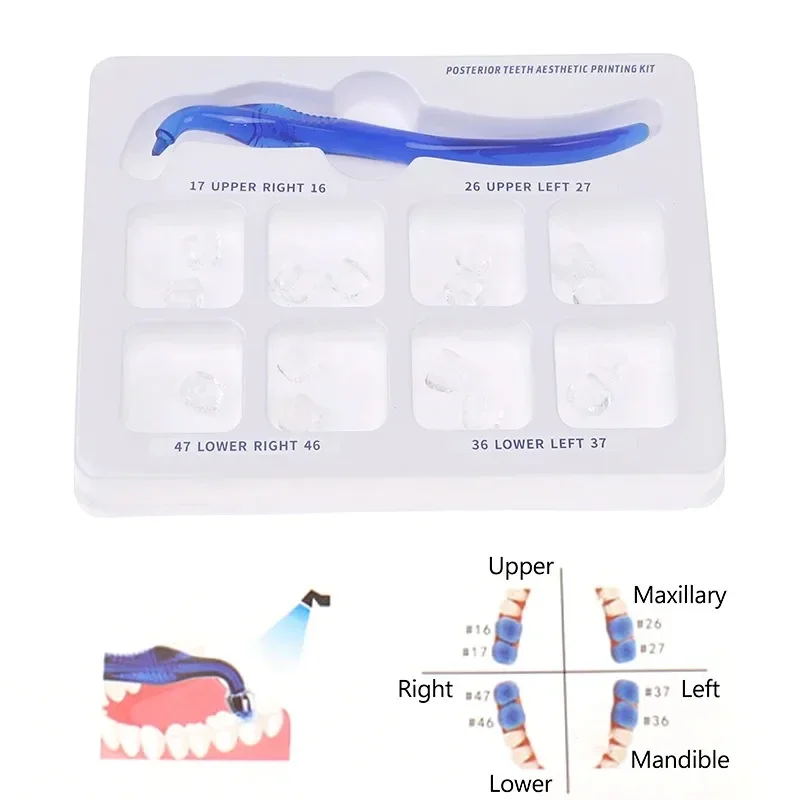 1x Dental Posterior Teeth Aesthetic Printing Mould Kit Professional Clinic Use for Light Cure Composite Restoration Filling Tool
