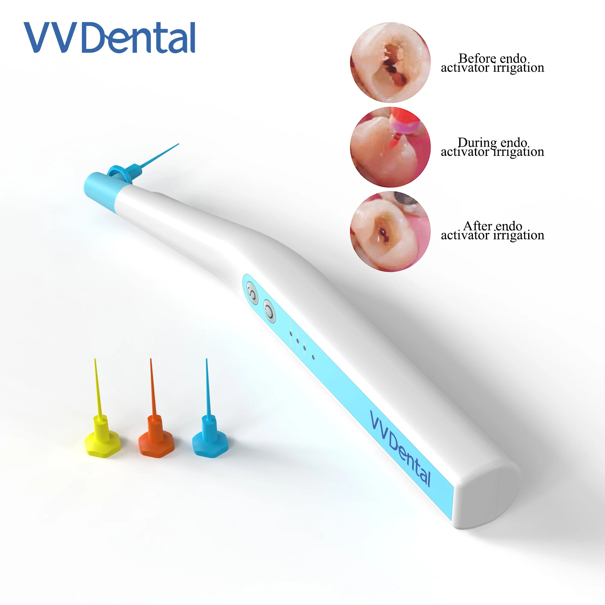 

VVDental Sonic Irrigator Tips Endo Activator With LED Light For Dental Instrument Root Canal Sonic Irrigator Endodontic Tools