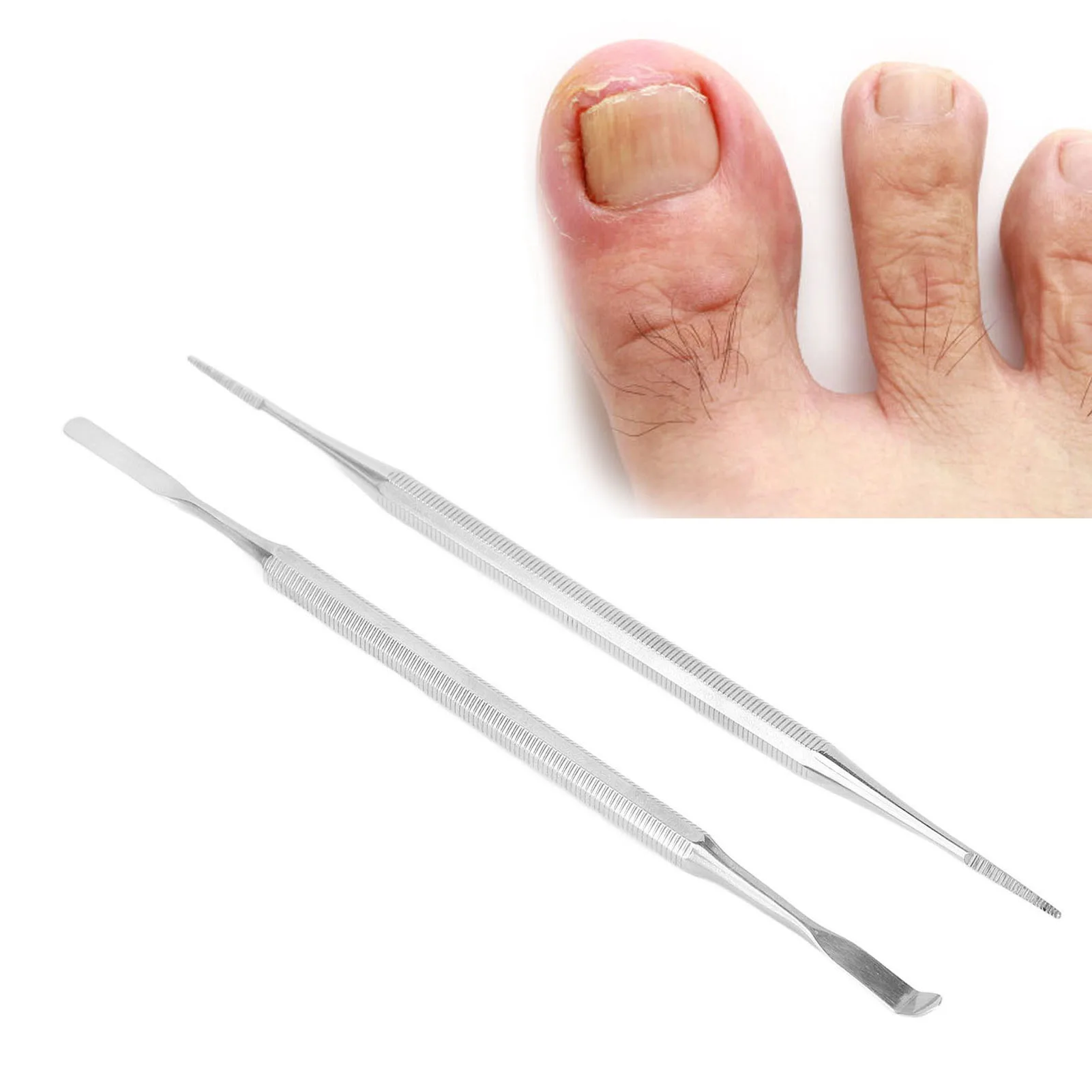 Ingrown Toenail File Ingrown Toenail Tool Kit Professional Stainless Steel Ingrown Toenail File Lifter Set Pedicure Tool