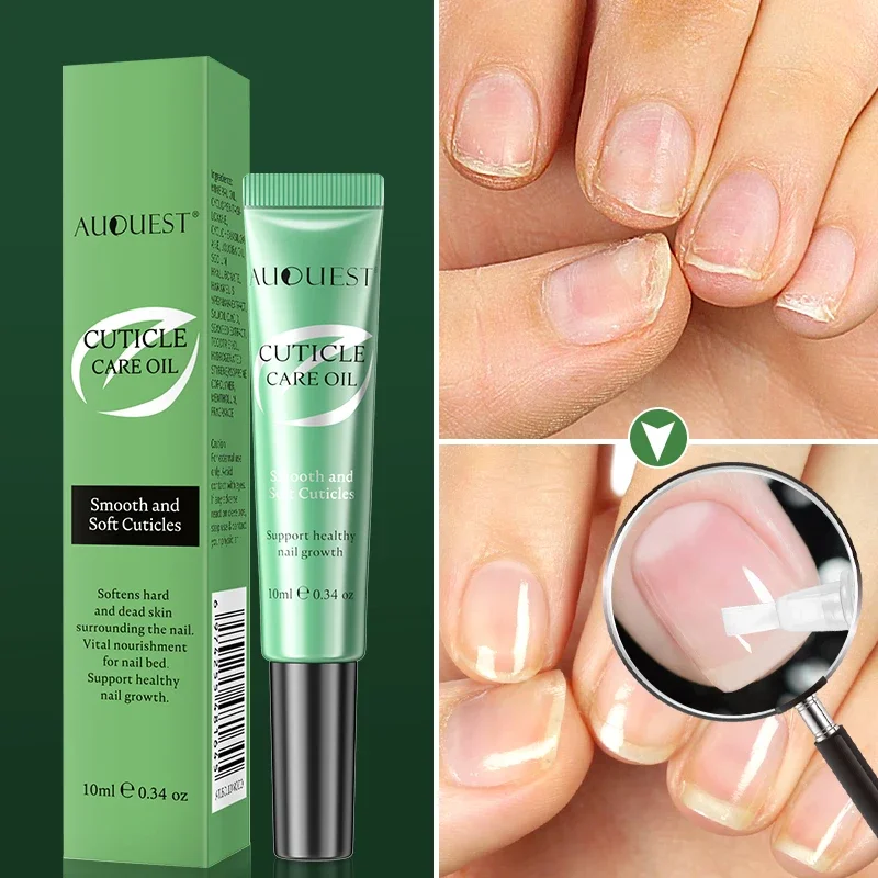 AUQUEST Cuticle Oil Pen for Beauty Health Nail Fungus Treatment Gel Nourishment Oil Softens Cuticles Nail Care 10ml