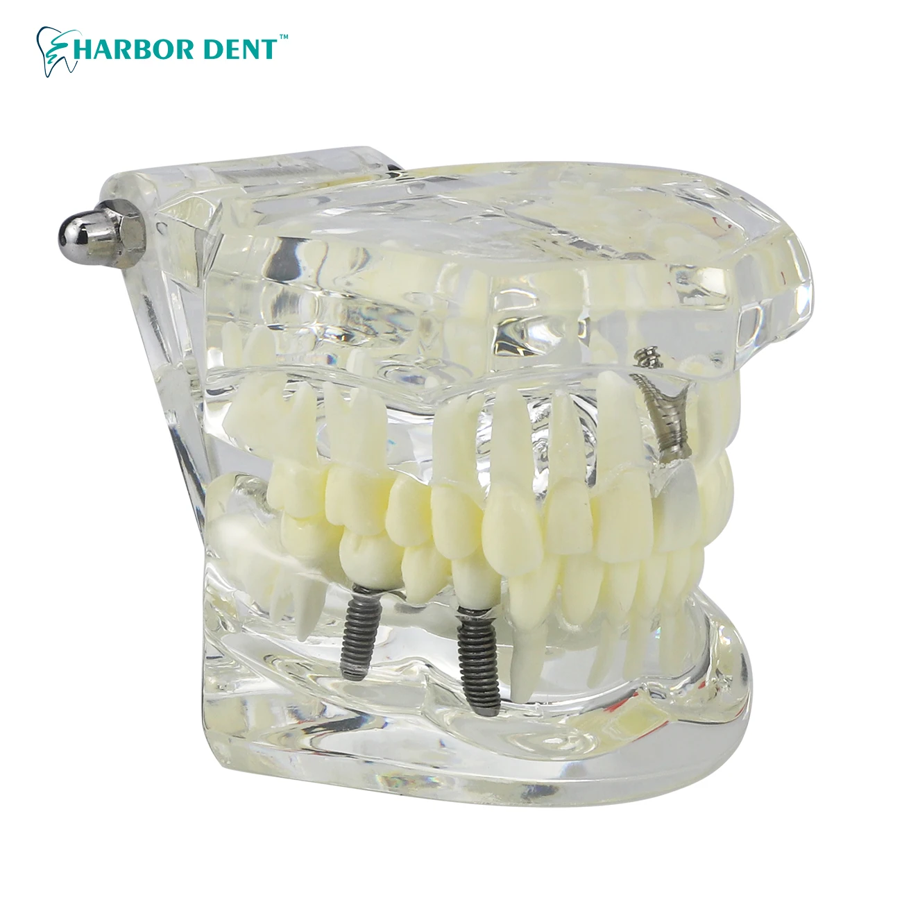 Dental Model Teeth Implant Restoration Bridge Teaching Study Medical Science Disease Dentist Dentistry Products Dental Gift