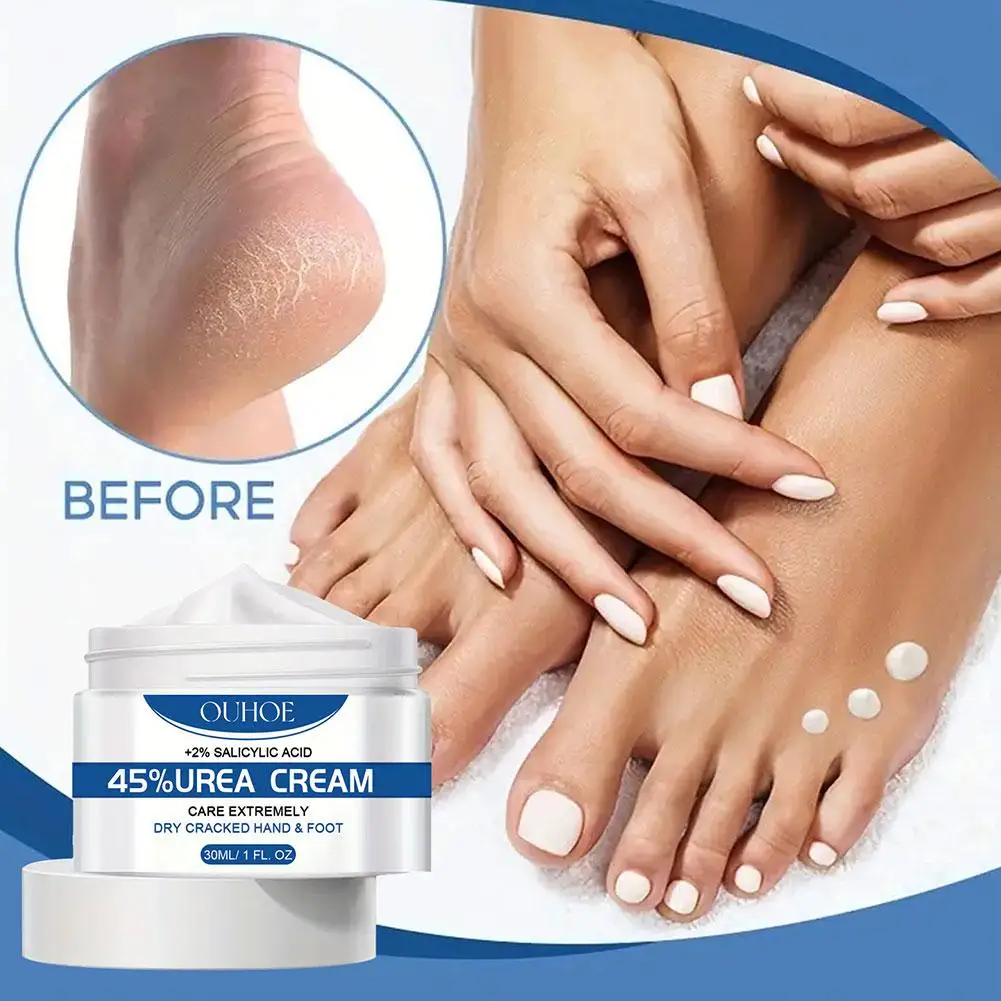 Crème anti-séchage pour les pieds, à l'urée, pour les callosités du talon, à fréquence, élimination de la peau, apaisante, réparation des gerçures, hydratante, soins des mains et des pieds