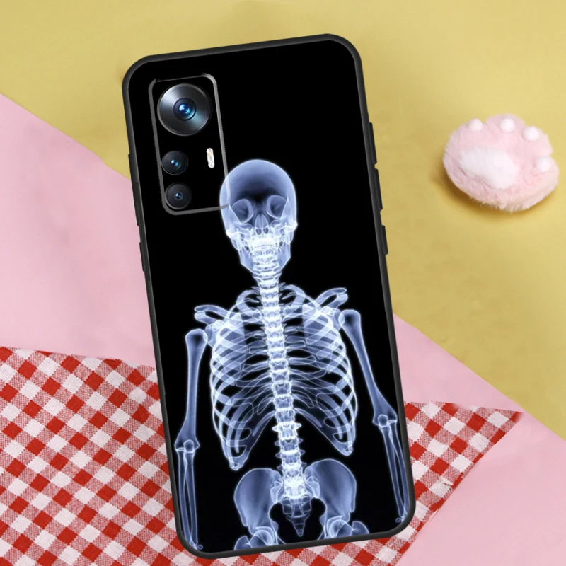 Radiological Human Organs Skeleton Case For Xiaomi 13 13T Pro 12T 11T 12 Lite 12X POCO X3 X5 Pro X4 F4 GT M5 M5s F3 F5 Funda