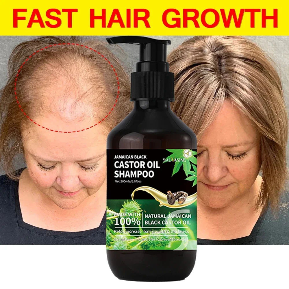 Jamaican Black Castor Oil Shampoo For Fast Hair Growth Permanently Prevents Hair Loss No Irritation To Scalp Hair Growth Product