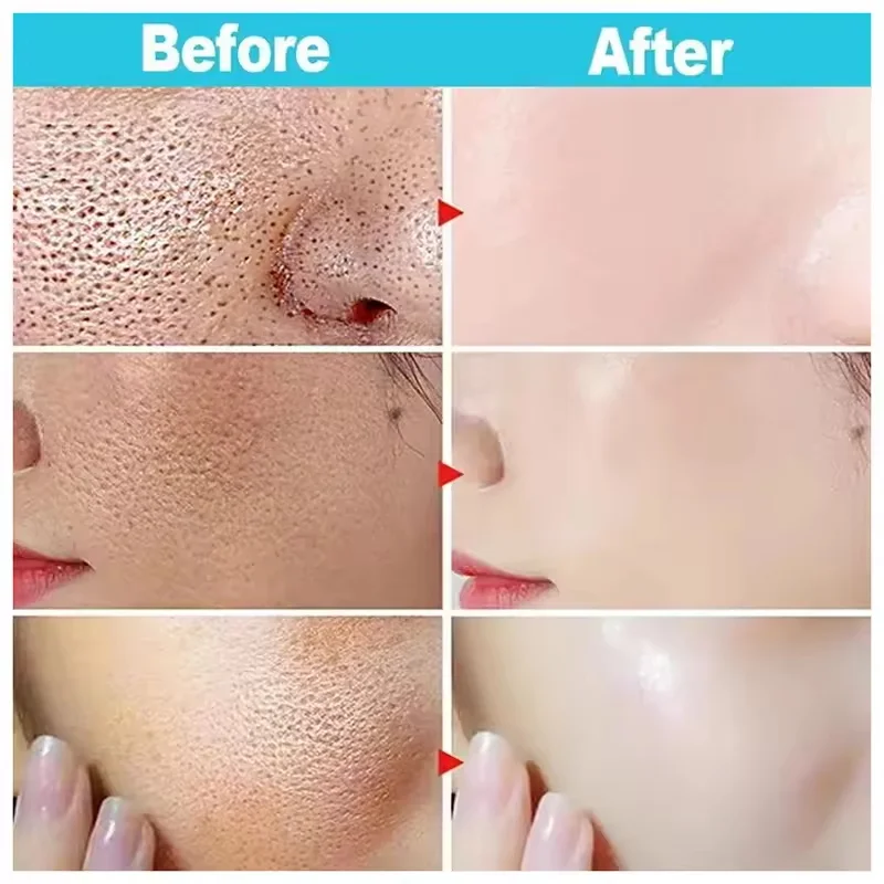 Rice Pore Shrinking Facial Serum Repairing Tightening Products Whitening Moisturizing Oil Control Skin Care Korean Cosmetics