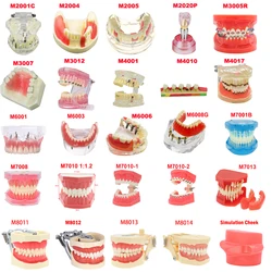 Multiple Types Dental Models Teeth Dental Teaching Model For Training Studying Orthodontic Implant Model Dentistry material