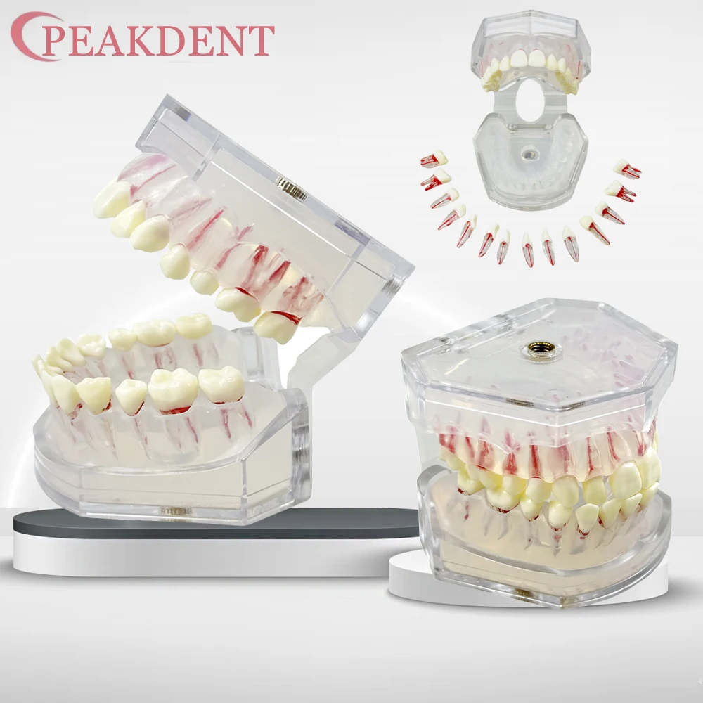

Dental Typodont Study Teaching Model Soft Gum with Removable Resin Teeth For Patient Education Demo Extraction Pratice Product
