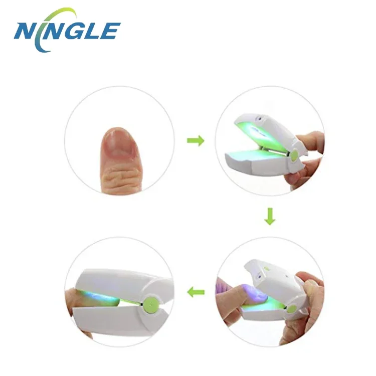 onychomycosis nails toe fungus removal topical medicine for toenail fungus finger and toe nail cleaning laser device