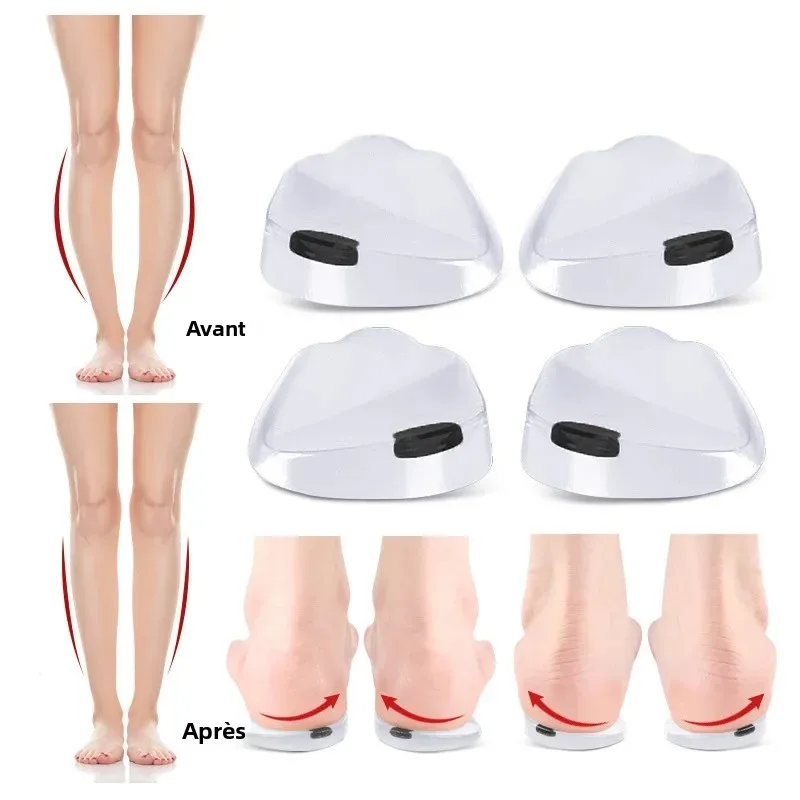 Semelles orthopédiques en gel avec aimants pour massage des pieds, en silicone, correction des jambes en O/X (valgus/varus) pour fasciite plantaire, inserts pour chaussures