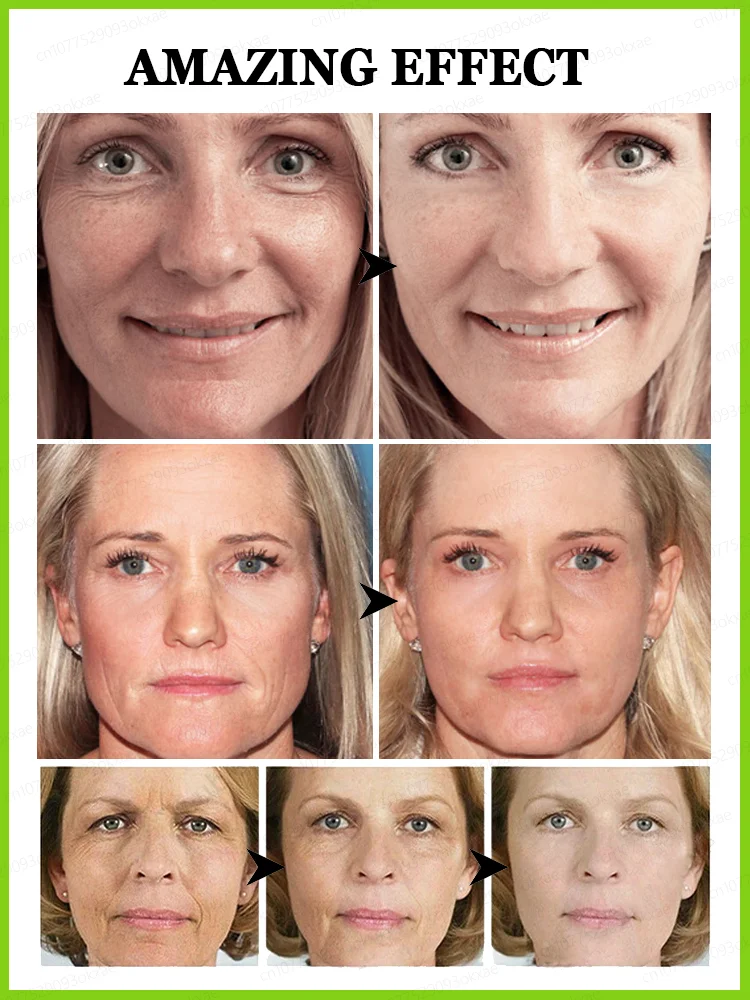 

Reduce all wrinkles and give you firm skin