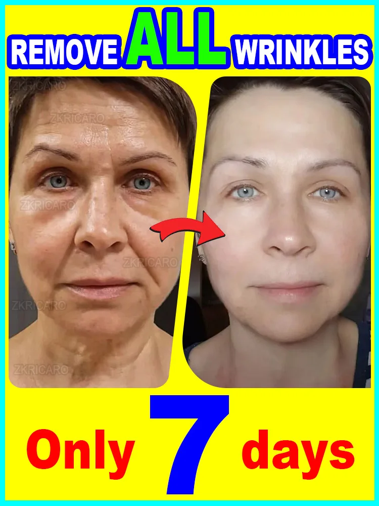 

20 years younger, 100% wrinkles disappear