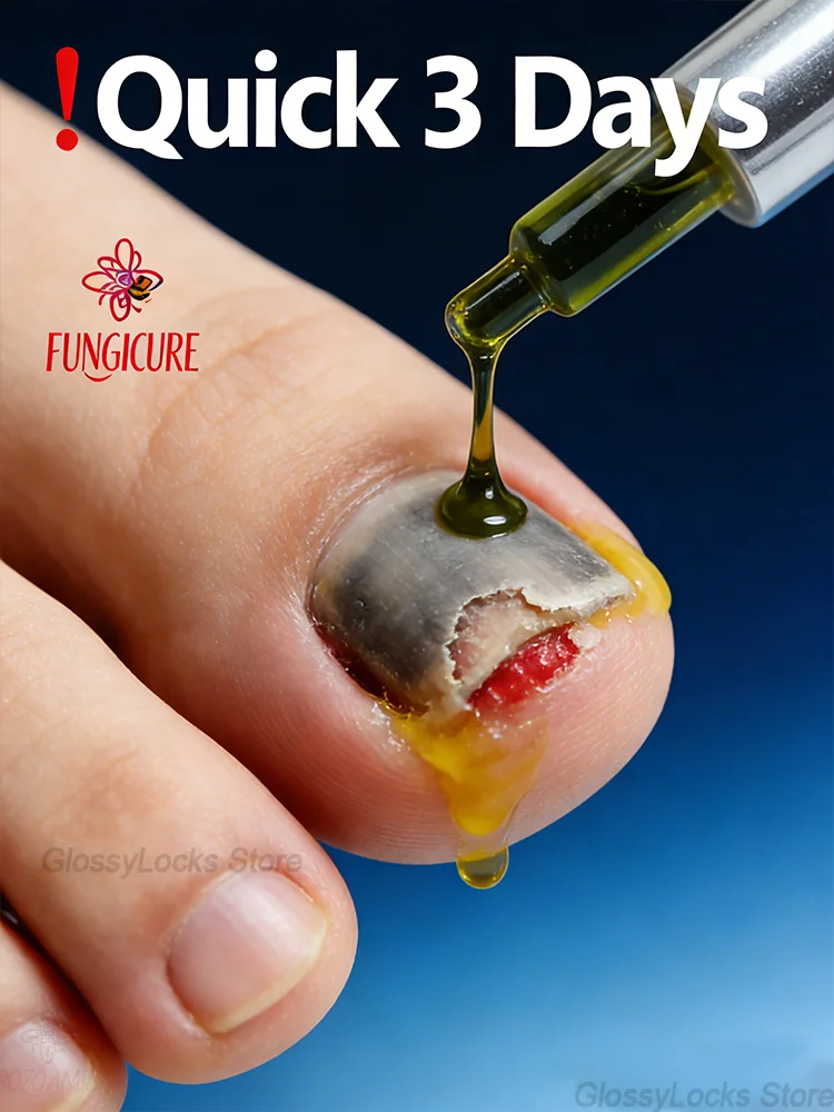 

Согчает поврежденные ногти + питает новые ногти, масло для лечения онихомикоза с двойнымэффектом, 뷰sシ