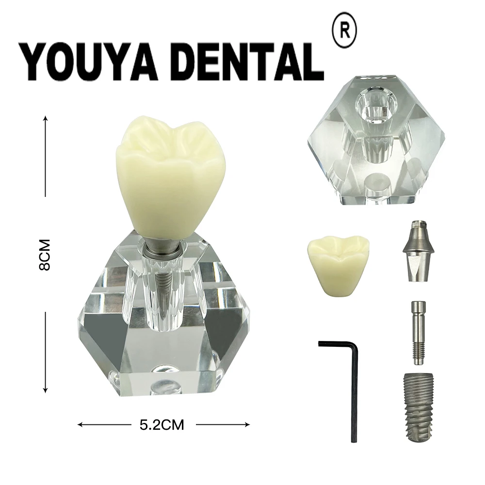 

4 Times Implant Model Dental Single Tooth Crown Base Teaching Models for Dentist Student Dental Clinics Demonstration Tools