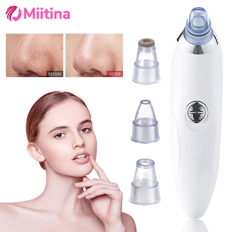 

Suction Blackheads Electric Blackheads Instrument Go Blackheads Face Pore Cleansing Beauty Instrument Radiant Facial Radiance