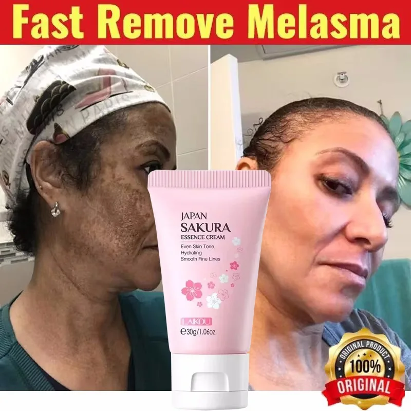 Whitening Freckle Cream Effective Remove Melasma Cream Remove Dark Spots Melanin Moisturize Brighten Smooth Face Skin Care