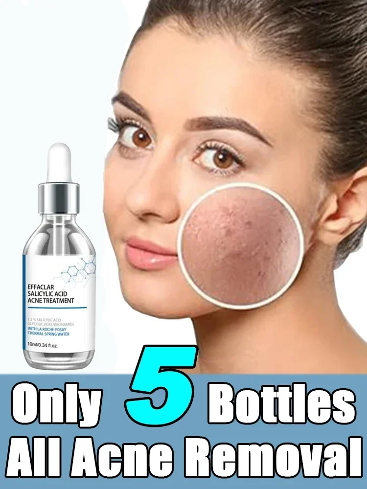 Glycolic Acid Glow Tonic Moisturizing Dullness Skin Care Essence Oil-controlling Anti-acne Toners Face Anti-acne Toners