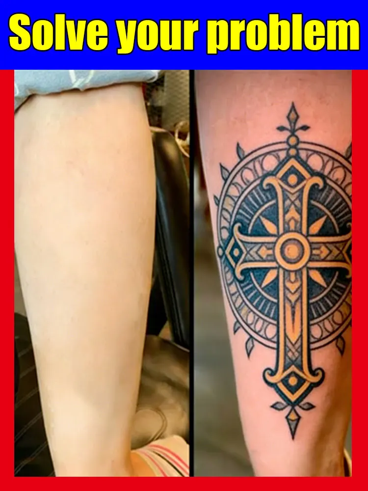 2026 Hot sale For the removal of colored permanent makeup tattoos